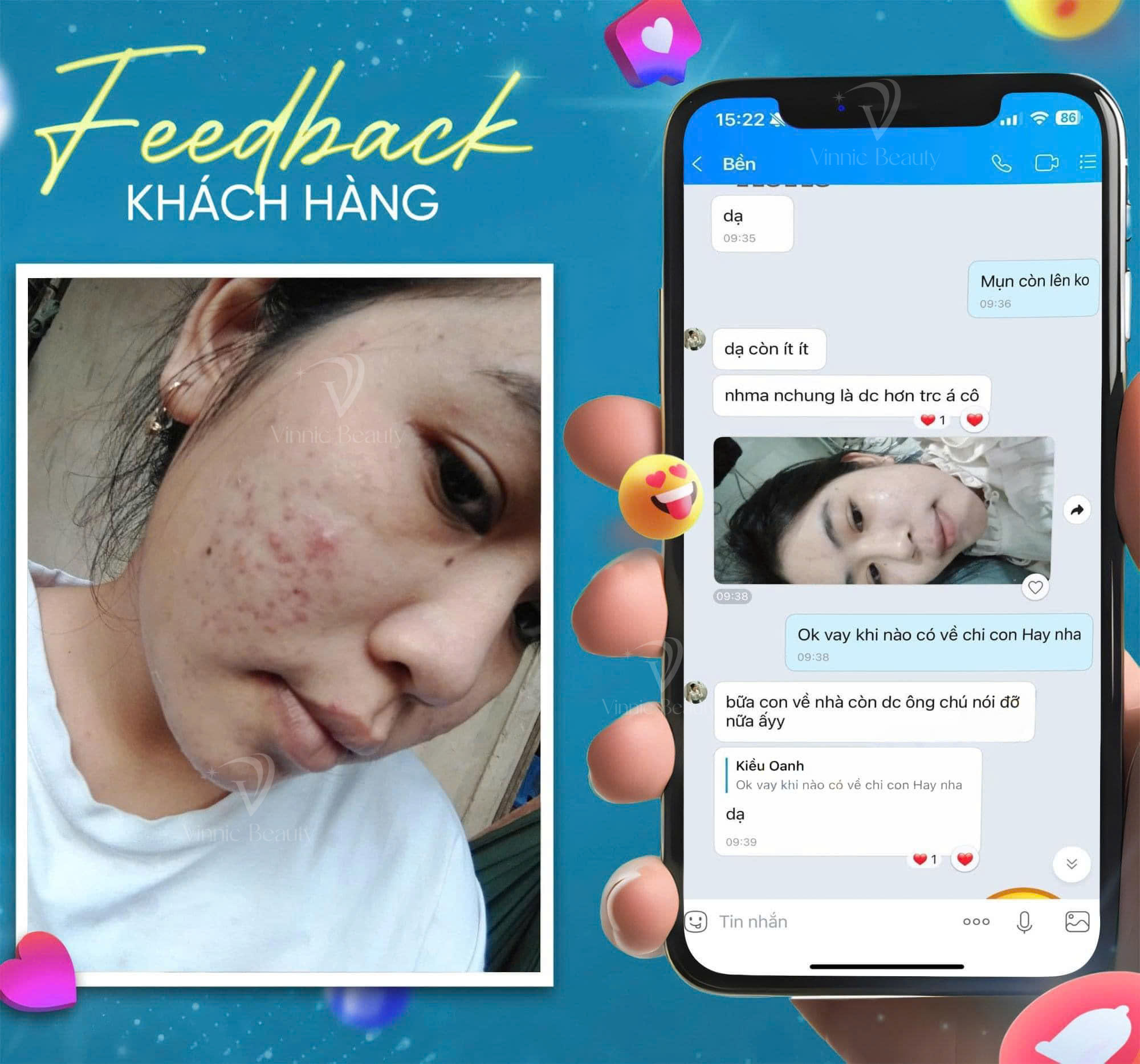 Tầm nhìn chiến lược và Sứ mệnh của Vinnic Beauty (1)