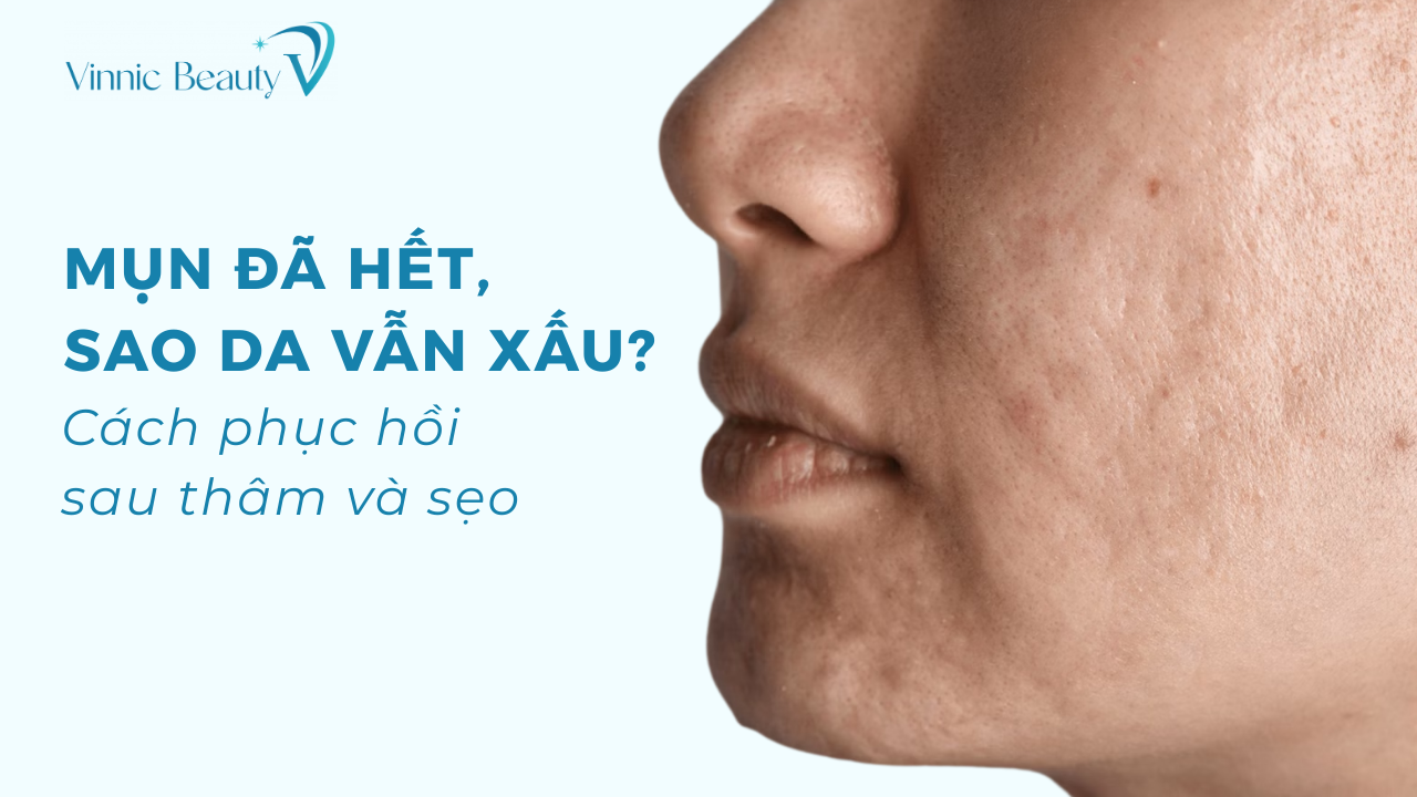 Cach phuc hoi sau tham va seo