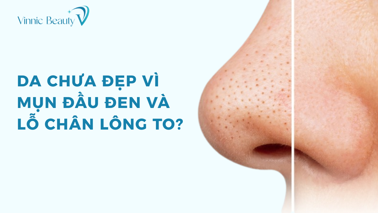 Da chua dep vi mun dau den va lo chan long to