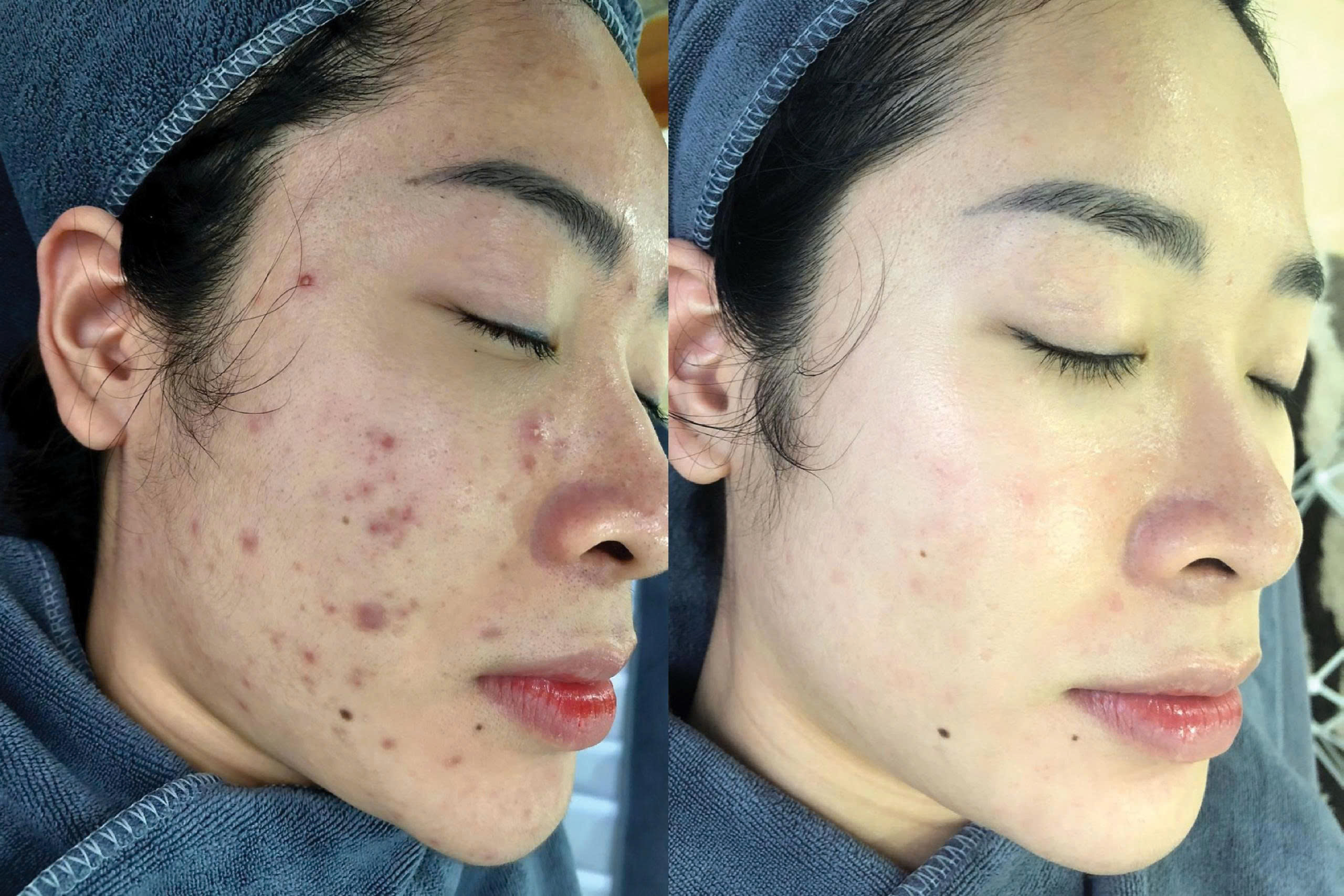 Seo tham V1