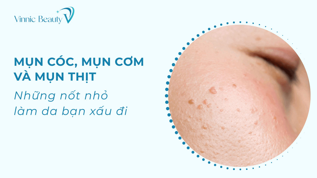 mun coc mun com mun thit khong nen xu ly tai nha