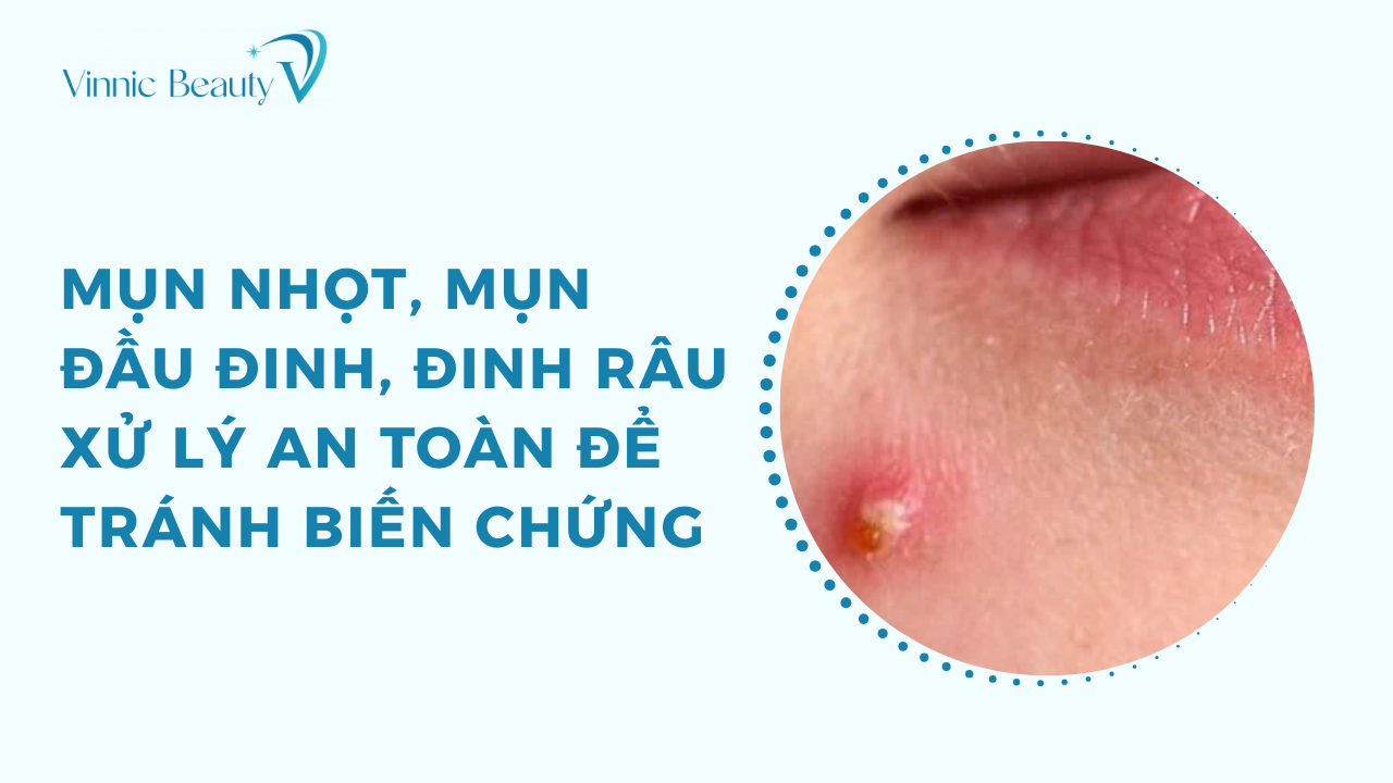 mun nhot mun dau dinh dinh rau xu ly an toan de tranh bien chung