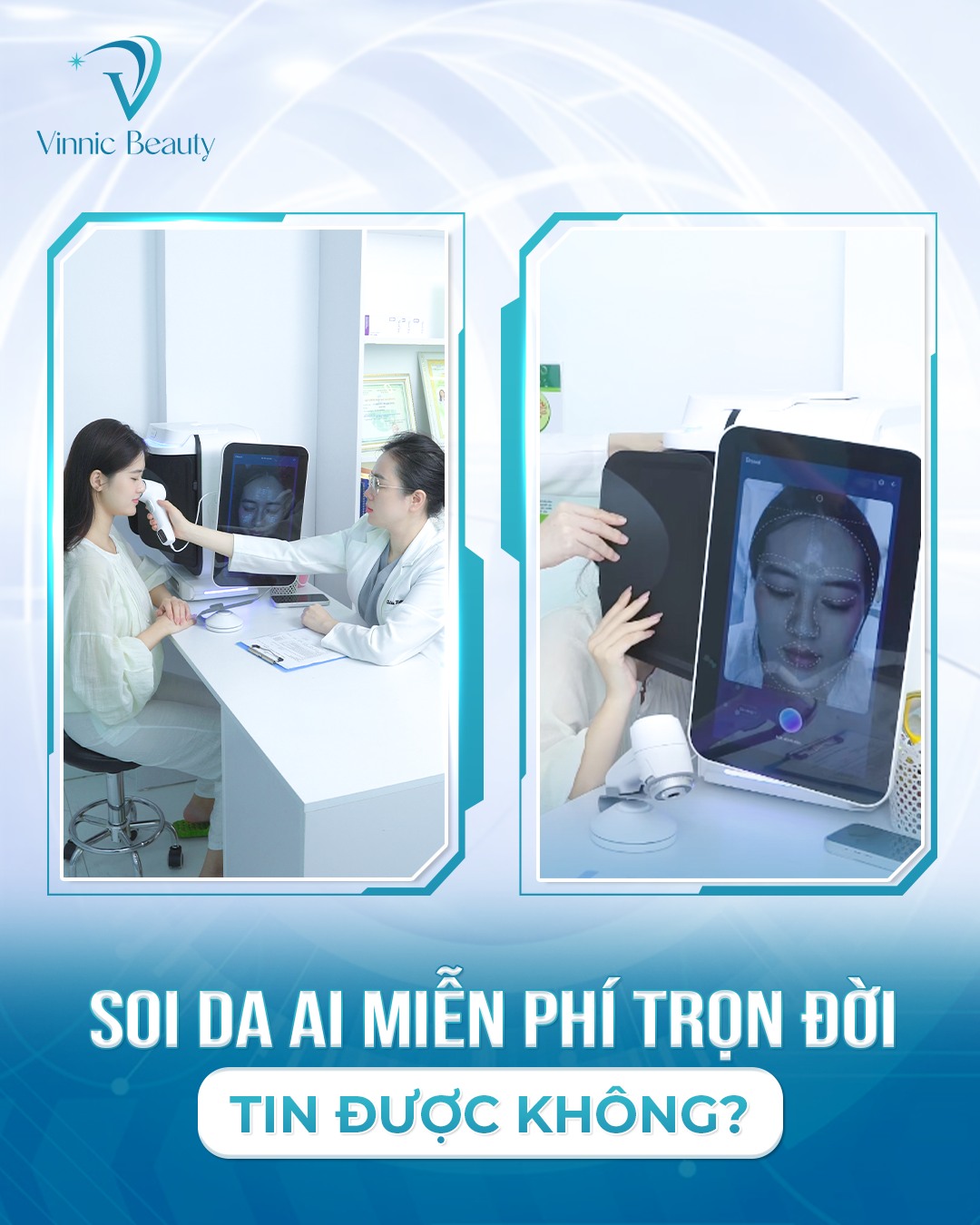 Các Loại Sẹo Rỗ Và Công Nghệ Điều Trị Phù Hợp Nhất Hiện Nay 4 Các Loại Sẹo Rỗ Và Công Nghệ Điều Trị Phù Hợp Nhất Hiện Nay