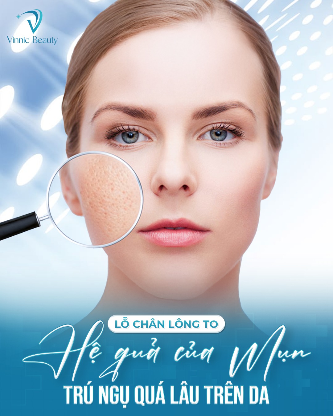 Lỗ Chân Lông To - Nạn Nhân Thầm Lặng Của Mụn Kéo Dài 2 Lỗ Chân Lông To - Nạn Nhân Thầm Lặng Của Mụn Kéo Dài (3)