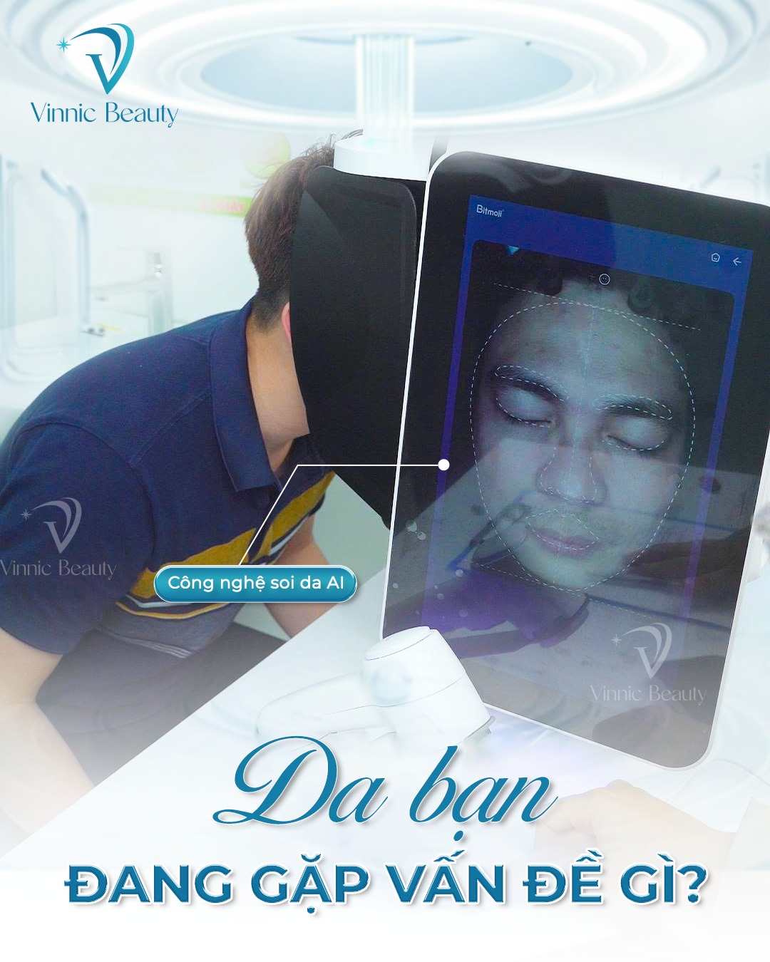 Lỗ Chân Lông To - Nạn Nhân Thầm Lặng Của Mụn Kéo Dài