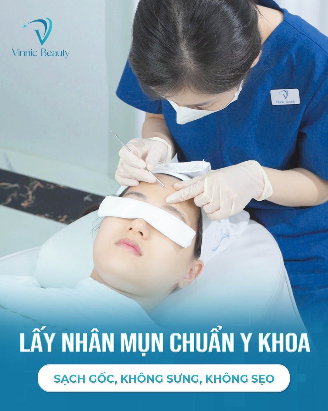 Nặn Mụn Xong Sao Lại Nổi Mụn Trắng Bác Sĩ Da Liễu Giải Đáp (2)