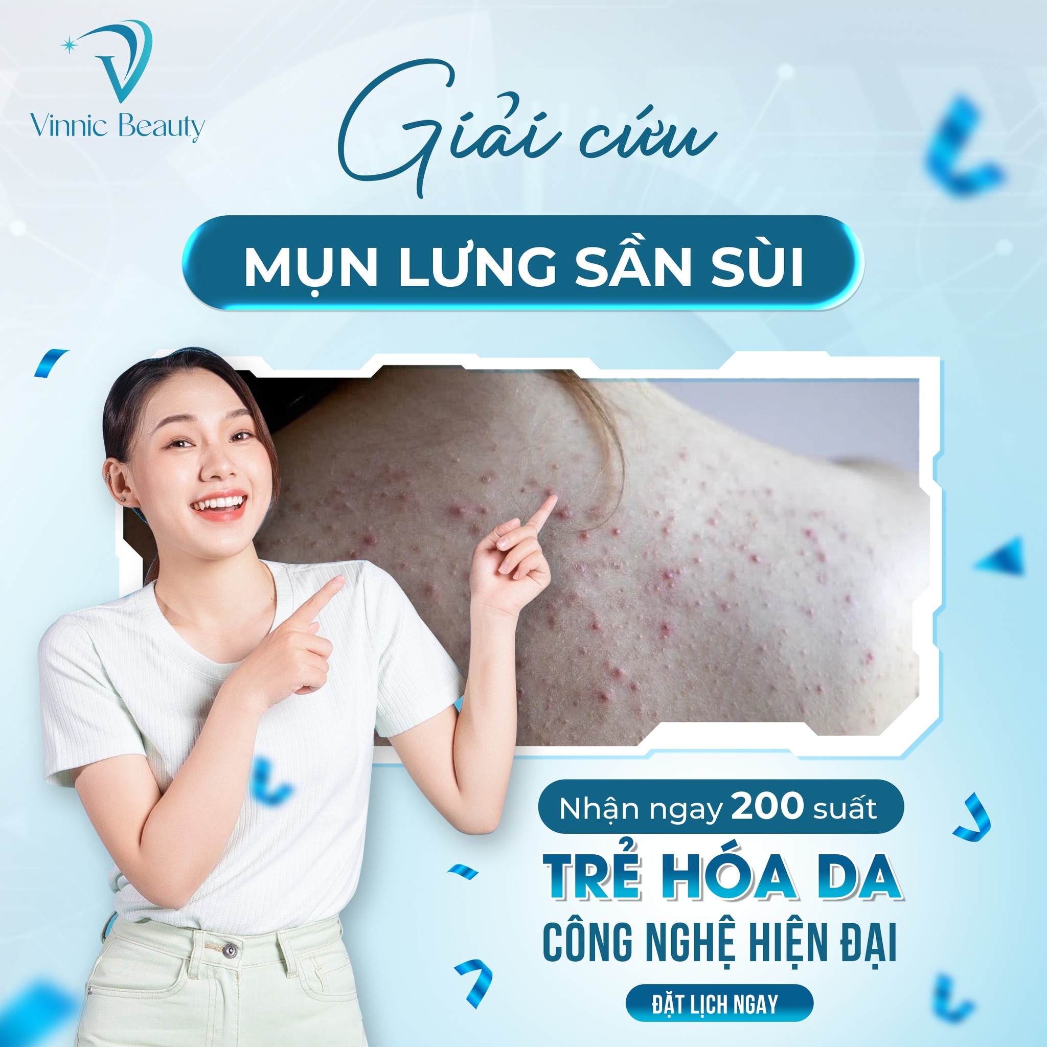 Hiểu Rõ Nguyên Nhân Gây Mụn Lưng Để Có Làn Da Mịn Màng Không Mụn 2 Nguyên Nhân Gây Mụn Lưng (3)