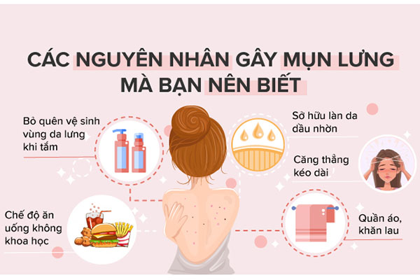 Hiểu Rõ Nguyên Nhân Gây Mụn Lưng Để Có Làn Da Mịn Màng Không Mụn 3 Nguyên nhân gây ra mụn lưng